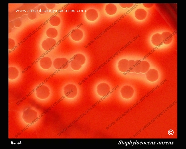 s.aureus colonies and hemolysis